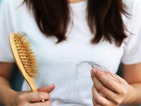 Đâu là nguyên nhân gây ra hiện rụng tóc ở người trẻ?